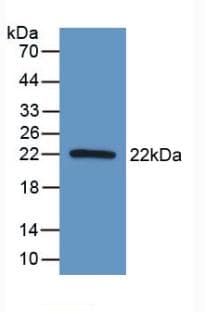 AATK / AATYK Antibody (aa1216-1374, PE)