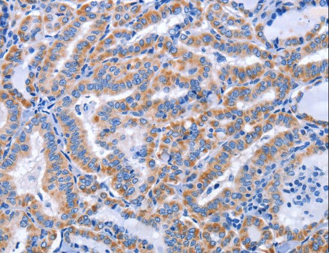 CCR6 Antibody