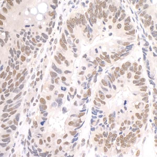 Polyclonal Rabbit anti-Human PD2 / PAF1 Antibody (aa475-525, IHC)