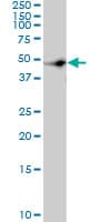 Monoclonal Mouse anti-Human c-Src Kinase / CSK Antibody (clone 3A3, WB)
