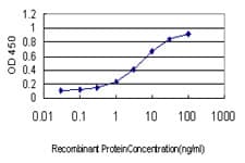 Monoclonal Mouse anti-Human BDKRB2/Bradykinin B2 Receptor Antibody (clone 3F6, WB)