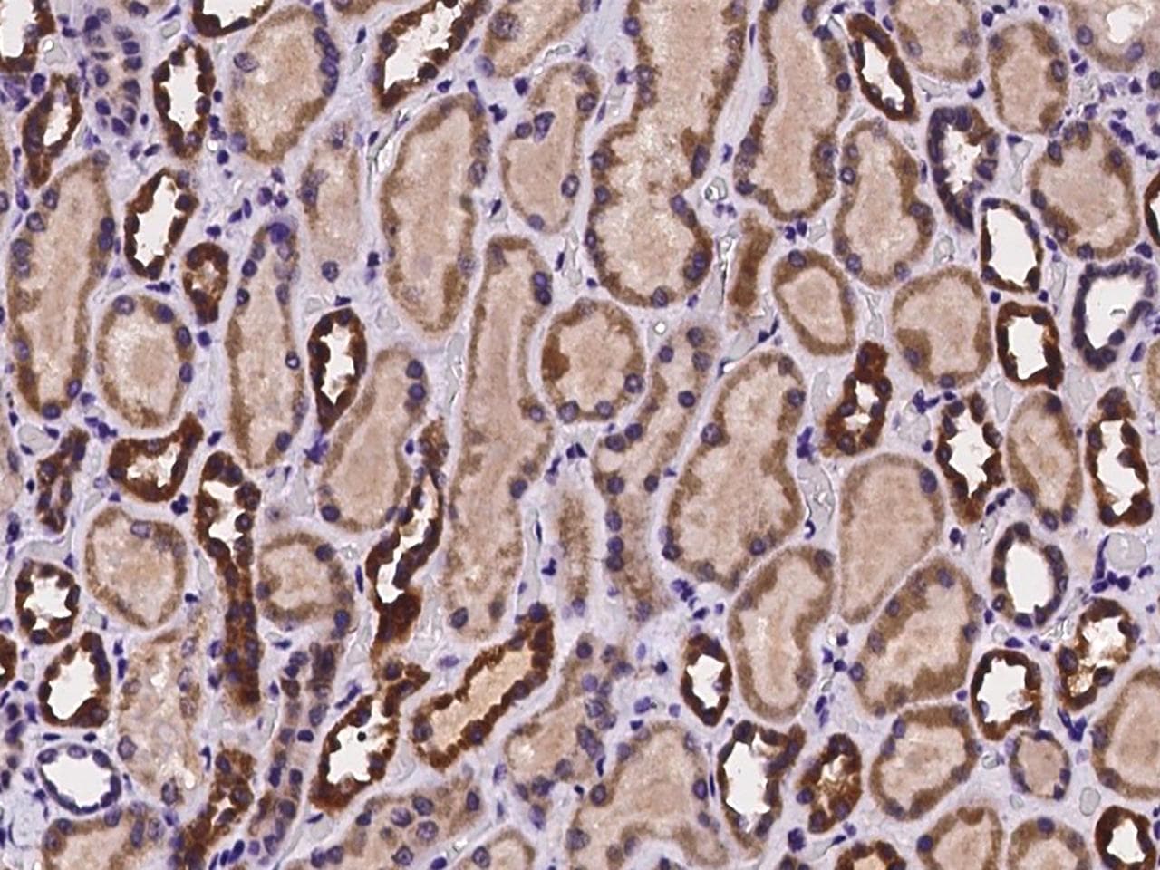 Polyclonal Rabbit anti-Human VSTM2L Antibody (IHC)