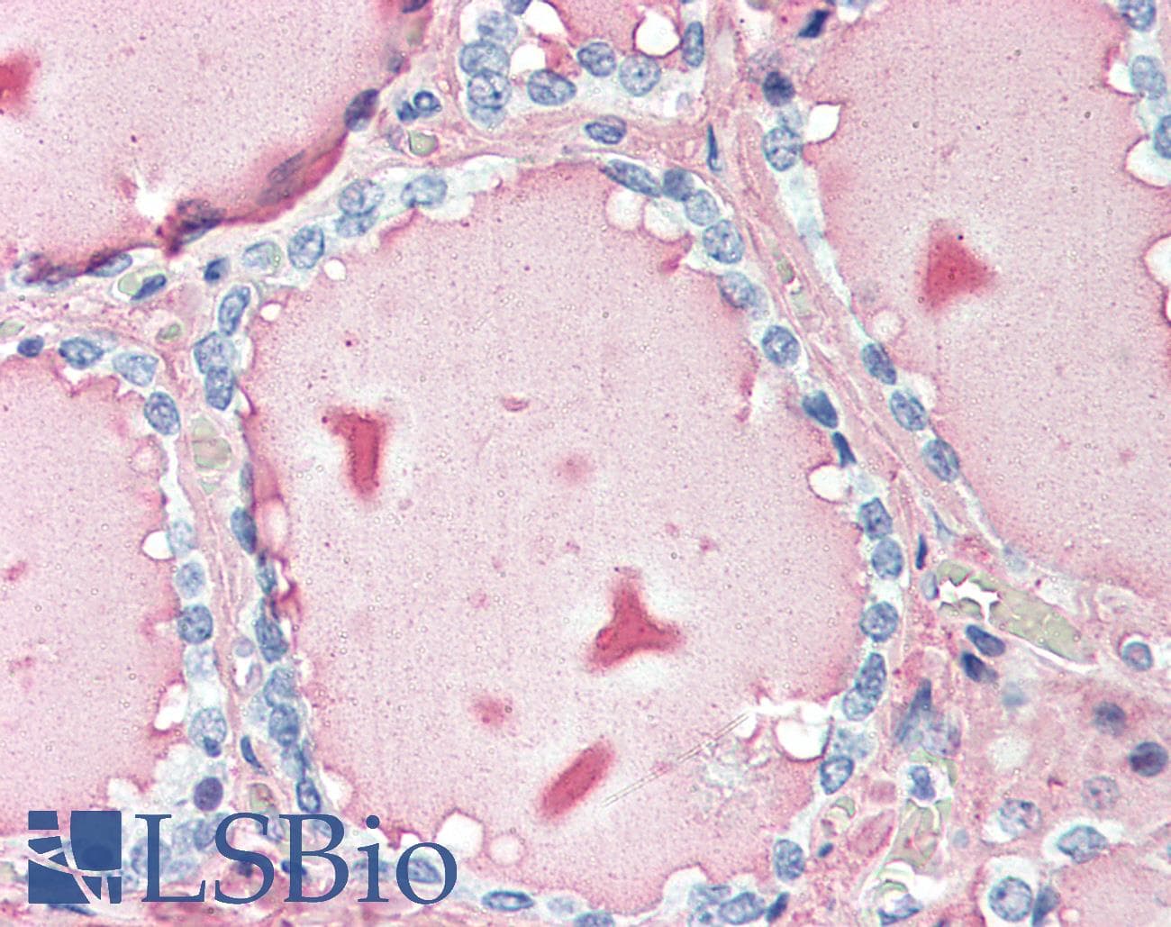 IHC-plus™ TG / Thyroglobulin Antibody