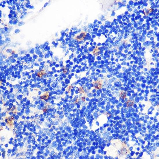 TGFB1 / TGF Beta 1 Antibody