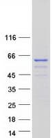 Human NELFB / COBRA1 Protein (Recombinant Myc-DDK (Flag))