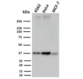 RAD51 / RECA Antibody (clone RAD51/2753)