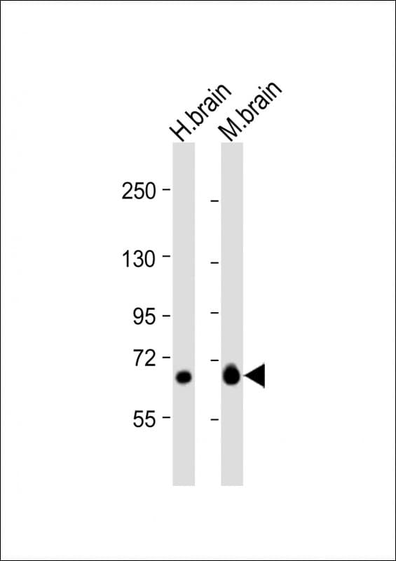 GLS / Glutaminase Antibody (aa144-177)