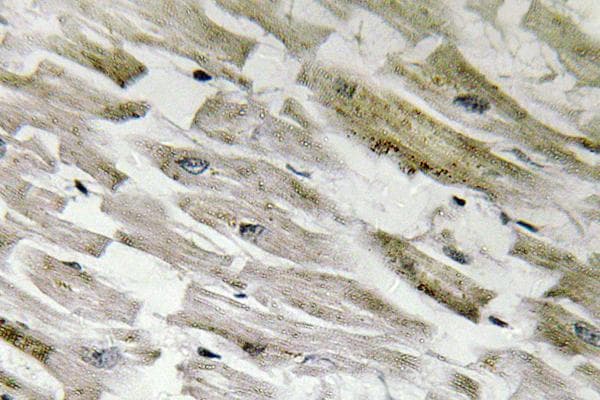 PPP1R14A / CPI-17 Antibody (phospho-Thr38)