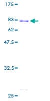 Human TADA3 / ADA3 Protein (Recombinant GST)