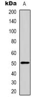 GDF6 / BMP13 Antibody (Internal)