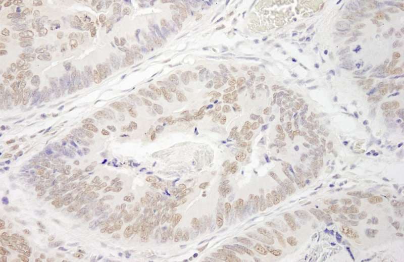 PRMT6 Antibody (aa325-C-term)