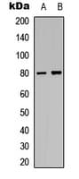 MAPT / Tau Antibody (phospho-Thr205)