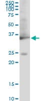 Monoclonal Mouse anti-Human GAPDH Antibody (clone 3C2, WB)