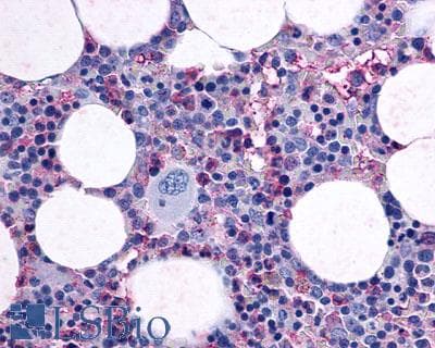 PathPlus™ F2RL3 / PAR4 Antibody (Cytoplasmic Domain)