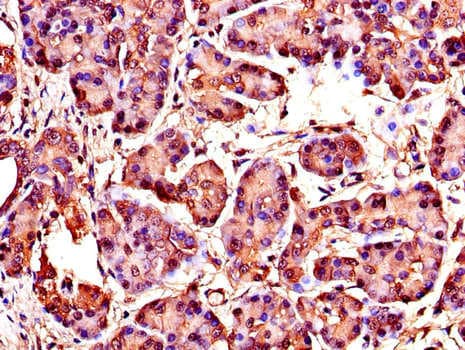 CCN4 / WISP1 Antibody