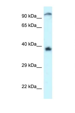 DOK7 Antibody (aa402-451)