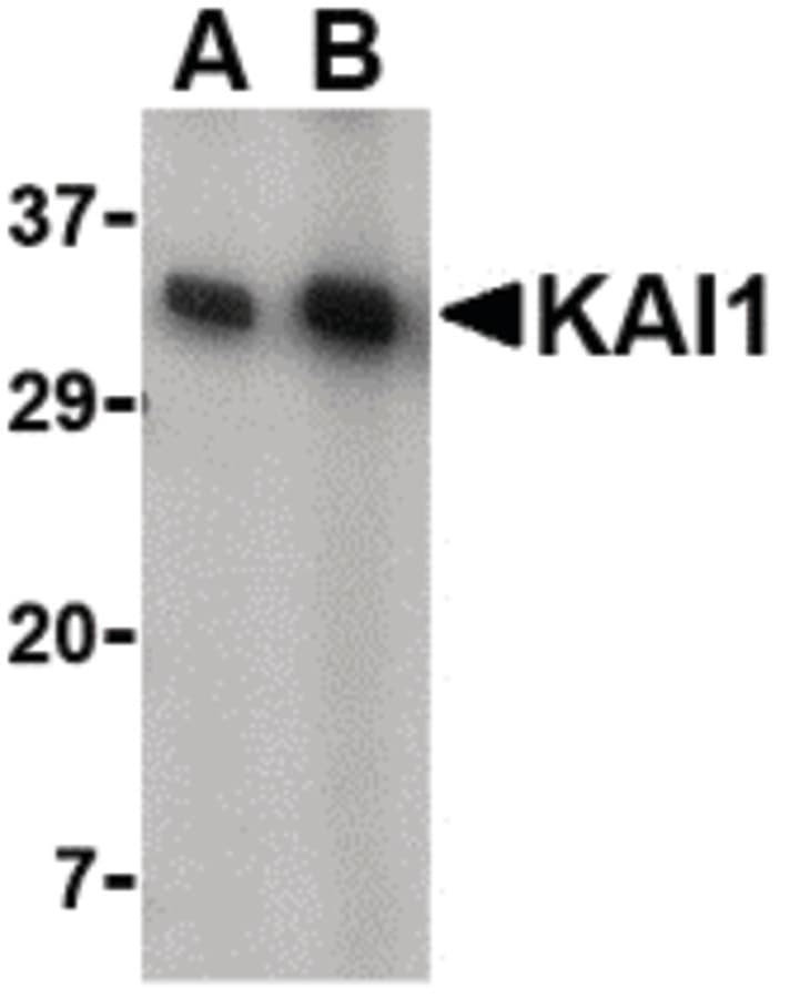 IHC-plus™ Polyclonal Rabbit anti-Human CD82 Antibody (IHC, IF, WB)