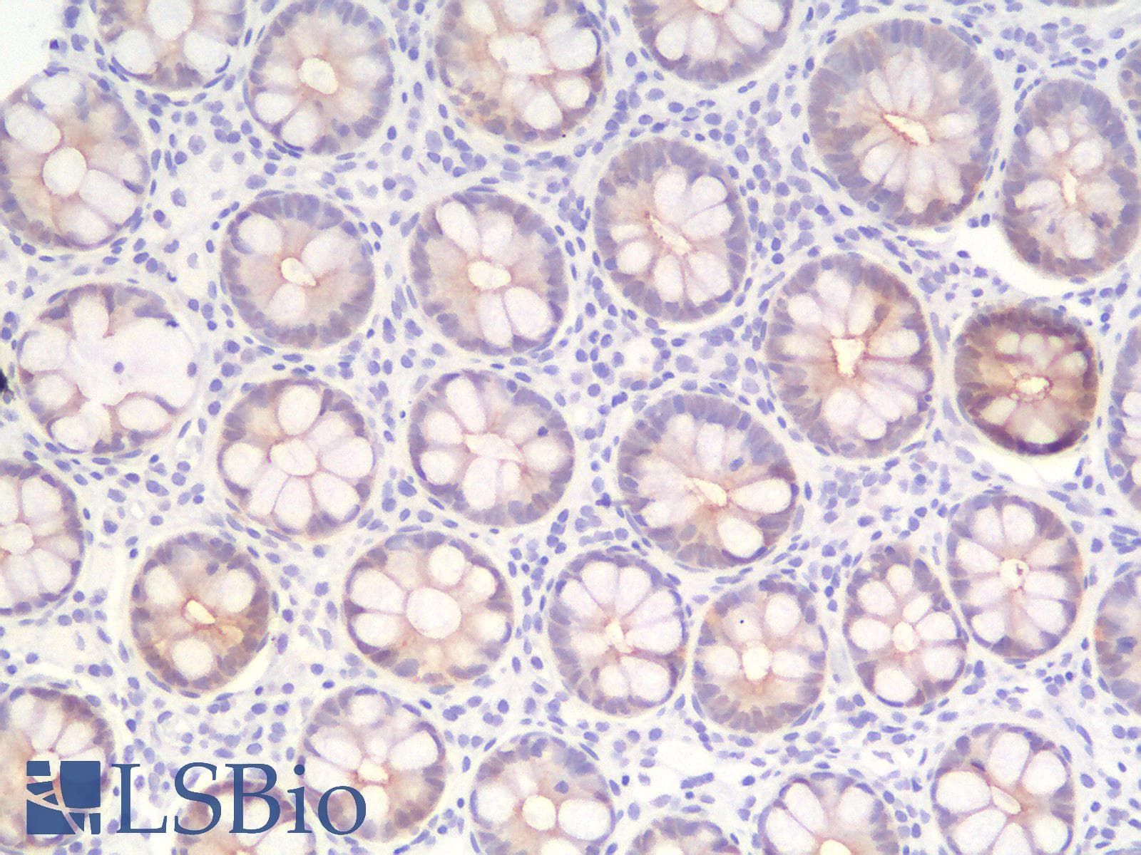 PathPlus™ Recombinant Monoclonal Rabbit anti-Human VIL1 / Villin Antibody (clone VIL1/2310R, aa179-311, IHC)