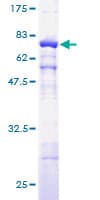 Human ACTG1 / Gamma Actin Protein (Recombinant GST)