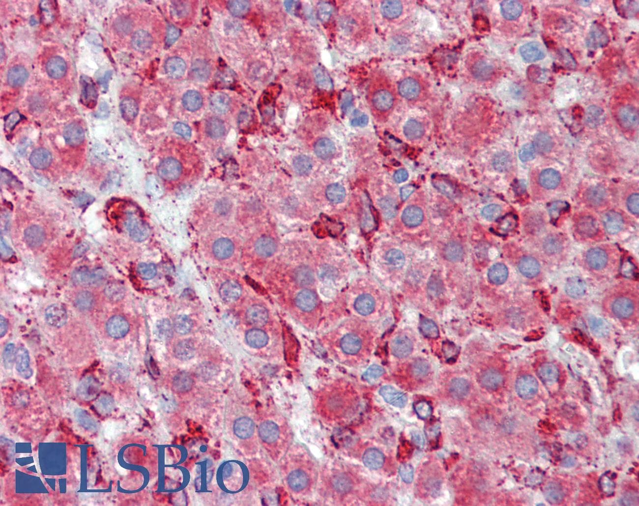 IHC-plus™ SERPINH1 / HSP47 Antibody (clone M16.10A1)