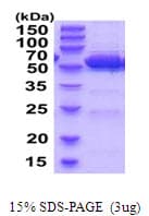 Mouse ALDH2 Protein (Recombinant His)