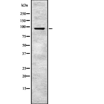Polyclonal Rabbit anti-Human EPS8 Antibody (WB)