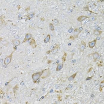 Polyclonal Rabbit anti-Human PDYN / ProDynorphin Antibody (IHC, WB)