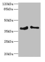 Polyclonal Rabbit anti-Human BCAP / PHF11 Antibody (IHC, WB)