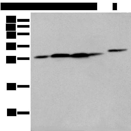 Polyclonal Rabbit anti-Human FKBP7 Antibody (IHC, WB)