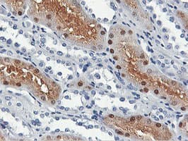 Monoclonal Mouse anti-Human SHPK / CARKL Antibody (clone OTI3D7, IHC, IF, WB)
