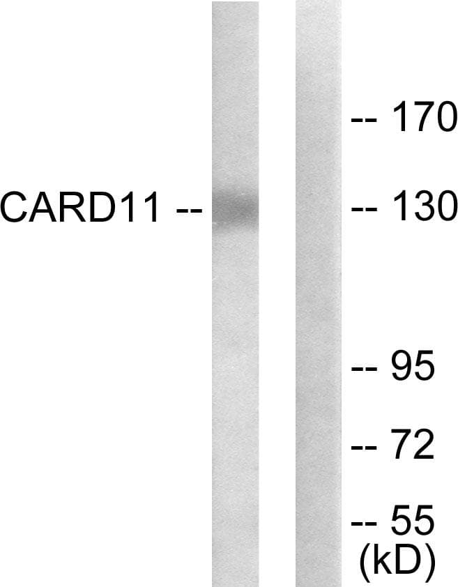 CARMA1 / CARD11 Antibody