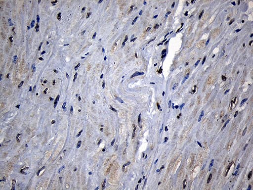 CPT1B Antibody (aa187-440, clone OTI2A6)