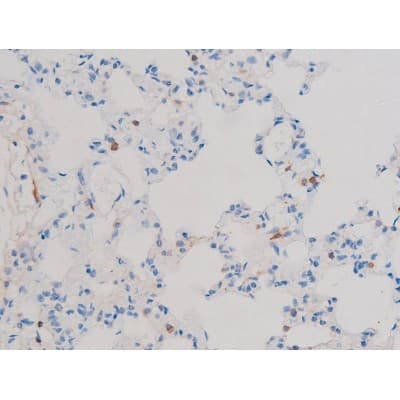 CDC25B Antibody (phospho-Ser323)
