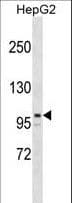 ARID5B Antibody (aa389-418)