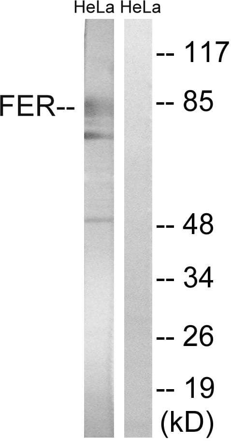 FER Antibody (p402)