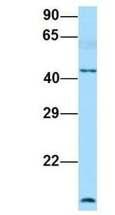 Polyclonal Rabbit anti-Human FLOT1 / Flotillin 1 Antibody (aa247-296, WB)