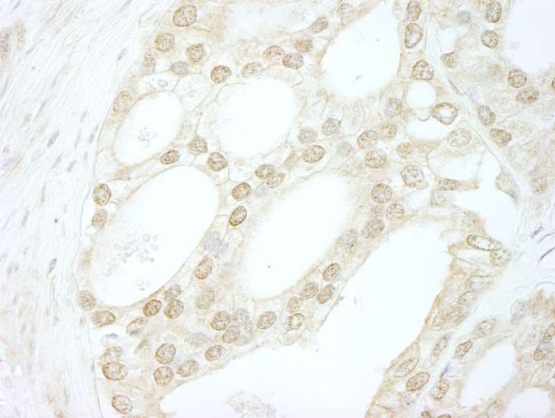Polyclonal Rabbit anti-Human MYBL2 Antibody (aa450-500, IHC)