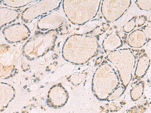 TCAP / Telethonin Antibody