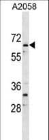 Polyclonal Rabbit anti-Human ARID5A Antibody (aa382-411, WB)