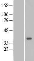 DTWD1 Protein (Over-Expression Lysate Myc-DDK (Flag))