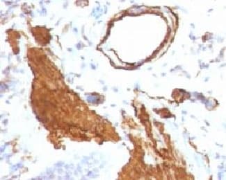 ACTA2 / Smooth Muscle Actin Antibody (clone ACTA2/791, Ready-to-Use)