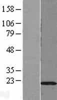DUSP22 / JSP 1 Protein (Over-Expression Lysate Myc-DDK (Flag))