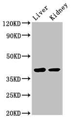 Polyclonal Rabbit anti-Human VASH2 Antibody (IHC, IF, WB)
