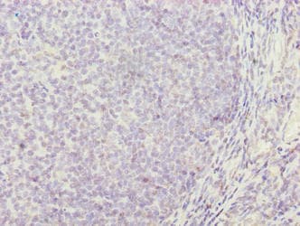 Polyclonal Rabbit anti-Human TRAT1 / TRIM Antibody (IHC)