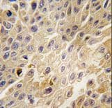 ADRBK1 / GRK2 Antibody (aa633-660)