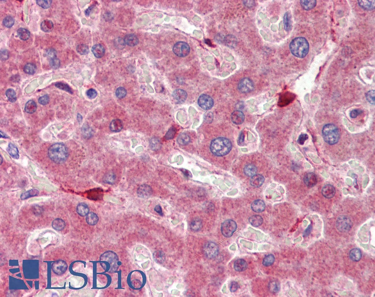 IHC-plus™ RBP1 / CRBP Antibody (aa122-135)