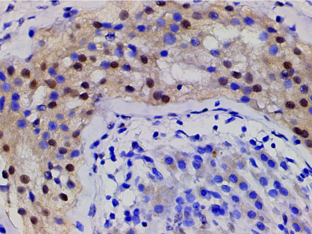 CFL1 / Cofilin Antibody (phospho-Ser3)