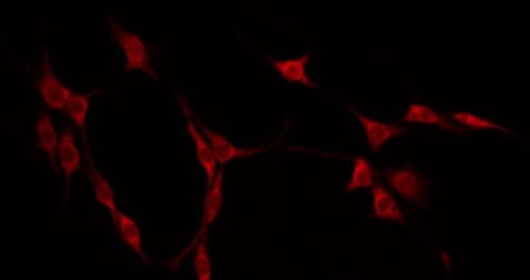 R3HCC1L / C10orf28 Antibody