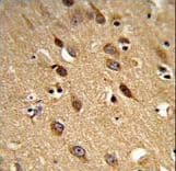 DJ858B16.2 / PISD Antibody (aa223-250)