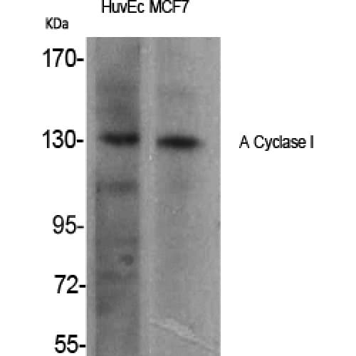 Polyclonal Rabbit anti-Human ADCY1 / Adenylate Cyclase 1 Antibody (200-280 aa, Internal, IHC, WB)